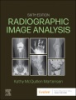 Radiographic_image_analysis
