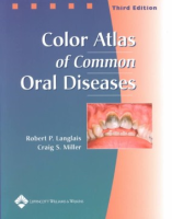 Color_atlas_of_common_oral_diseases